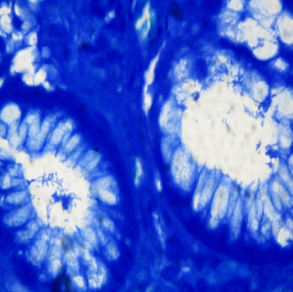 Comparative study using routine stains and Immunohistochemistry staining techniques for detection of Helicobacter pylori