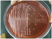 Characterisation of Acinetobacter with special reference to carbapenem resistance and biofilm formation