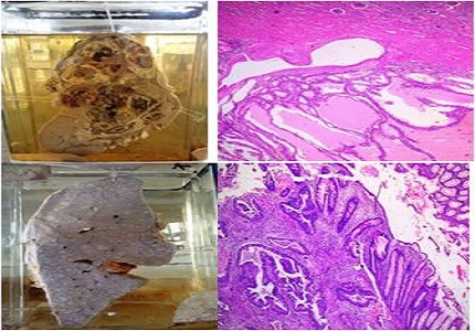 Effectiveness of a multimedia resource in histopathology practical teaching in medical undergraduates-a comparative study