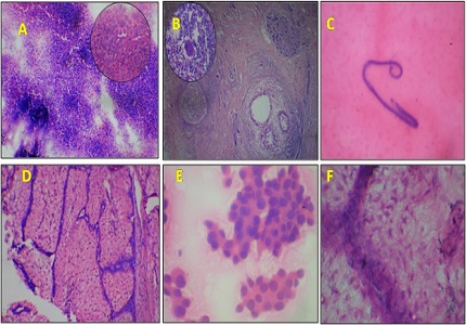 A prospective study of the palpable lesions of the breast and the role of FNAC in these lesions with available histopathology methods