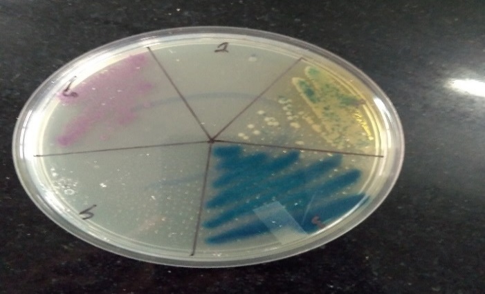 Bacteriological profile and its antibiotic susceptibility in patients ...